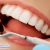 [Imagen:¡Paga Q85 en lugar de Q550 por Limpieza Dental Completa que Incluye: Desmanchado Dental con Profijet + Eliminación de Sarro y Placa con Ultrasonido + Aplicación Tópica de Flúor + 2 Radiografías Digitales + Examen Diagnóstico en DentalMedic!]