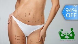 [Imagen:¡Lipoescultura sin Cirugía! 150 Tratamientos Reductores: 30 Mesoterapias, 20 Masajes Moldeadores y Más.]