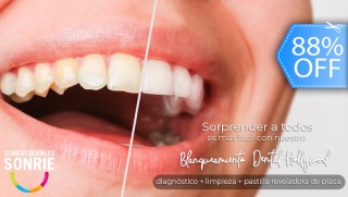 [Imagen:Blanqueamiento Dental LED, Limpieza Ultrasónica, Eliminación de Manchas, Pulido y Más.]