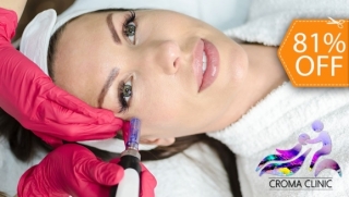 [Imagen:Rejuvenecimiento Facial con Dermapen + Peeling con Espátula Biosónica]