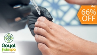 [Image: Nueva Técnica: Tratamiento con Ácido para la Eliminación de Hongos Hasta en 5 Uñasm]