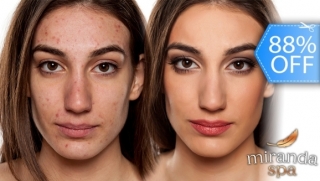 [Image: Facial Antiacné con Limpieza Profunda, Peeling, Microdermoabrasión y Más.m]