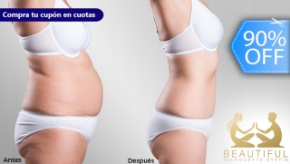 [Image: ¡Nueva Figura en 4 Semanas! Tratamiento Reductivo - Anti-Obesidad, Focalizado, para Cuerpo Completom]
