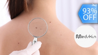 [Image: Cauterización Láser de Verrugas, Cabeza de Vena o Lunares + Evaluación Médicam]