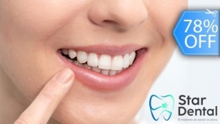 [Image: Blanqueamiento Dental Químico con Luz LED, Limpieza Dental, Eliminación de Manchas y Másm]