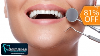 [Image: 3 Rellenos o 4 Sellantes Dentales + Limpieza con Ultrasonido y Másm]