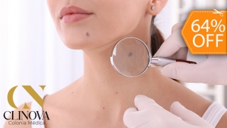 [Image: Eliminación de Hasta 15 Verrugas, Acrocordones, Mezquinos o Cabezas de Vena con Plasma Pen o Electrocauterizaciónm]
