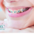 [Imagen:¡Paga Q599 en lugar de Q1,800 por Paquete de Ortodoncia con: Colocación de Brackets Metálicos (Superiores e Inferiores) + Evaluación y Diagnóstico Clínico + Profilaxis Dental + Fotografías y Modelo de Estudio!]