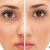 [Image: ¡Paga $16 en Lugar de $75 por Microdermoabrasión con Punta de Diamante + Limpieza Facial + Exfoliación + Vaporización + Extracción de Puntos Negros + Mascarilla de Yogurt y Frutos Rojos Marca Anubis + Aromaterapia!m]