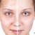 [Image: ¡Paga $16 en Lugar de $75 por Microdermoabrasión con Punta de Diamante + Limpieza Facial + Exfoliación + Vaporización + Extracción de Puntos Negros + Mascarilla de Yogurt y Frutos Rojos Marca Anubis + Aromaterapia!m]