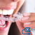 [Image: ¡Paga $18 en Lugar de $75 por Férula Dental para Tratamiento Contra Rechinado de Dientes (Bruxismo) + Evaluación Dental + Limpieza con Ultrasonido + Aplicación Tópica de Flúor!m]