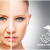 [Image: ¡Paga $199 en Lugar de $1,050 por Rejuvenecimiento Facial con 3 Plasmas Ricos en Plaquetas + 3 Microdermoabrasiones + 3 Mascarillas de Preparación y 3 Mascarillas Relajantes!m]