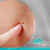 [Image: ¡Paga $20 en Lugar de $100 por Eliminación de hasta 20 Verrugas o Cabezas de Vena en Cuello, Axilas o Rostro + Consulta Dermatológica!m]