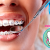 [Image: ¡Paga $75 en Lugar de $200 por Colocación de Brackets Metálicos + Evaluación y Diagnóstico Clínico + Fotografías y Modelo de Estudio!m]