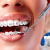 [Image: ¡Paga Q549 en lugar de Q2,200 por Colocación de Brackets Metálicos Superiores e Inferiores + Evaluación y Diagnóstico + Limpieza Dental + Fotografías y Modelo de Estudio!m]