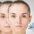 [Image: ¡Paga $199 en Lugar de $450 por 3 Sesiones de Rejuvenecimiento Facial con: 3 Plasmas Ricos en Plaquetas + 3 Microdermoabrasiones + 3 Extracciones de Puntos + 3 Limpiezas Faciales + Consulta Médica!m]