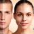 [Image: ¡Paga Q99 en lugar de Q1,050 por Facial Láser Antiacné, Antiaging o Antimanchas + 1 Mascarilla Personalizada + Examen Diagnóstico Profesional!m]