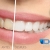 [Image: ¡Paga Q395 en lugar de Q1,100 por Blanqueamiento Dental Químico con Luz LED + Pulido Dental + Aplicación de Flúor!m]