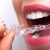 [Image: ¡Paga $15 en Lugar de $125 por Férula Dental + Evaluación Dental + Limpieza con Ultrasonido + Aplicación Tópica de Flúor!m]