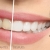 [Image: ¡Paga $50 en Lugar de $310 por Blanqueamiento Dental Químico con Luz LED + Limpieza Dental (Detartraje) + Consulta Odontológica!m]