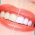 [Image: ¡Paga $59 en Lugar de $195 por Blanqueamiento Dental Químico con Luz LED + Limpieza Manual + Profilaxis (Pulido Dental) + Consulta Odontológica!m]