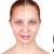 [Image: ¡Paga Q249 en lugar de Q650 por Tratamiento para Reducir Las Cicatrices del Acné que Incluye: Plasma Rico en Plaquetas + Fototerapia con Máscara LED + Altafrecuencia + Mascarilla Neutralizadora + Limpieza Facial!m]