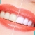 [Image: ¡Paga $59 en Lugar de $195 por Blanqueamiento Dental Químico con Luz LED + Limpieza Manual + Profilaxis (Pulido Dental) + Consulta Odontológica!m]