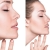 [Image: ¡Paga Q1,899 en lugar de Q10,500 por Rinomodelación o Rejuvenecimiento Facial con Hilos Tensores + Aplicación de Ácido Hialurónico o Plasma Gel + 1 Limpieza Facial Profunda + Microdermoabrasión + Evaluación!m]