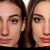 [Image: ¡Paga Q99 en Lugar de Q800 por Facial Antiacné con Limpieza Profunda + Extracción + Peeling Ultrasónico + Microdermoabrasión + Tónico Seboregulador + Terapia LED + Mascarilla Personalizada + Cauterización de Barros + Aplicación de Protector Solar!m]