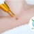 [Image: ¡Paga Q149 en Lugar de Q900 por Cauterización Láser de hasta 20 Cabezas de Vena o 4 Lunares o 4 Verrugas (de hasta 5 mm) + Evaluación Médica!m]