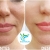[Image: ¡Paga Q999 en lugar de Q4,500 por Lifting de Párpados (Superiores o Inferiores) o de Labio Superior (Código de Barras) con Plasma Láser!m]