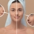 [Image: ¡Paga Q99 en Lugar de Q400 por Facial Antiacné y Antimanchas que Incluye: 1 Microdermoabrasión + 1 Radiofrecuencia 1 Limpieza Facial + 1 Exfoliación + 1 Vapor de Ozono + 1 Extracción de Puntos Negros + 1 Velo de Colágeno y Más!m]