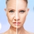 [Image: ¡Paga Q199 en vez de Q2,800 por Rejuvenecimiento y Relleno Facial para Eliminar Arrugas, Líneas de Expresión y Cicatrices que Incluye: ¡Rellenos con Células Madre, Aplicación de Enzimas Plaquetarias, Estiramiento, Tensado Facial y Más!m]