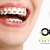 [Image: ¡Paga $90 en Lugar de $450 por Colocación de Brackets Metálicos + Evaluación y Diagnóstico Clínico + Fotografías y Modelo de Estudio + 3 Consultas de Control!m]