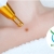 [Image: ¡Paga Q149 en Lugar de Q900 por Cauterización Láser de hasta 20 Cabezas de Vena o 4 Lunares o 4 Verrugas (de hasta 5 mm) + Evaluación Médica!m]