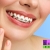 [Imagen:¡Paga Q499 en Lugar de Q3,000 por Colocación de Mini-Brackets Metálicos (Superiores e Inferiores) + Evaluación y Diagnóstico Clínico + Profilaxis Dental + Fotografías!]