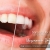 [Image: ¡Paga Q449 en Lugar de Q3,598 por Blanqueamiento Dental con Luz LED + Limpieza Ultrasónica Profunda con Eliminación de Sarro y de Manchas de Colorantes con Pulido Profiject + Pastilla Reveladora de Placa + Diagnóstico Integral Completo!m]