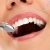 [Image: ¡Paga $25 en Lugar de $200 por Reconstrucción Mínimamente Invasiva de 4 Dientes Frontales + Consulta General + Revisión de Cordales + Limpieza dental + Aplicación Tópica de Flúor!m]