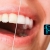 [Imagen:¡Paga $50 en Lugar de $120 por 1 Aplicación de Blanqueamiento Dental Químico con Luz LED + Limpieza con Ultrasonido + Profilaxis (Pulido Dental) + Consulta Odontológica!]