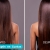[Image: ¡El Alisado que Tu Cabello Necesita! ¡Paga Q399 en Lugar de Q1,400 por Alisado de Keratina LED Inteligente y Personalizado + Kit de Shampoo y Acondicionador + Reactivación!m]