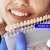 [Image: ¡Paga $62.50 en Lugar de $125 por Carilla Dental de Cerómero + Limpieza Dental con Ultrasonido!m]
