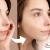 [Image: ¡Paga Q169 en Lugar de Q900 por Terapia Clínica Anti Acné: Luz Pulsada en 2 Puntos del Rostro + Alta Frecuencia + Exfoliación Suave + Extracción de Impurezas + Mascarilla Combinada Descongestiva y Desinfectante!m]