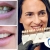 [Image: ¡Mejora la Forma y el Color de tu Sonrisa! ¡Paga $62.50 en Lugar de $125 por Carilla Dental de Cerómero + Limpieza Dental con Ultrasonido!m]