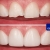 [Image: ¡Paga $40 en Lugar de $230 por Reconstrucción Estética con Resina de 4 Dientes Frontales + Consulta General + Revisión de Cordales + Limpieza Dental + Aplicación Tópica de Flúor!m]