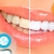 [Image: ¡Paga $35 en lugar de $120 por Blanqueamiento Dental de 2 Cubetas + Limpieza con Ultrasonido + Pulido con Bicarbonato + Diagnóstico con Cámara Intraoral en Clínicas Médicas Romano!m]