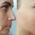 [Image: ¡Paga Q1,299 en Lugar de Q20,000 por Armonización Facial con Tratamiento Personalizado que Incluye: Bioestimulación + Aplicación de Ácido Hialurónico + Rellenos Faciales + Aparatología Médica + Aplicación de Botox + Evaluación!m]