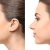 [Image: ¡Paga Q1,999 en Lugar de Q11,000 por Rinomodelación o Rejuvenecimiento Facial con Ácido Hialurónico + PRP + 1 Limpieza Facial Profunda + Microdermoabrasión + 1 Sesión de Lipólisis QUEMA GRASA CORPORAL!m]