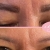 [Image: ¡Paga $50 en Lugar de $100 por 2 Sesiones Láser para Remover o Aclarar Micropigmentación de Cejas!m]