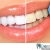 [Image: ¡Paga Q395 en lugar de Q1,500 por Blanqueamiento Dental Láser + Limpieza y Pulido Dental con Profilaxis + Eliminación de Sarro con Ultrasonido + Aplicación Tópica de Flúor + Examen Diagnóstico en Dental Life!m]