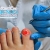 [Image: ¡Elimina los Hongos de las Uñas YA! ¡Paga Q75 en lugar de Q750 por Sesión Láser para Hongos en 1 Uña en Valencia Clínica Dermatológica!m]